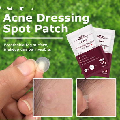 Invisible Spot Treatment Patches | Dealtide Spot Treatment